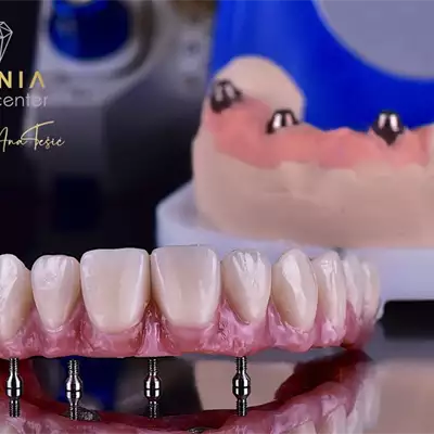 Aponia Dental Centar