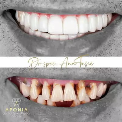 Aponia Dental Centar