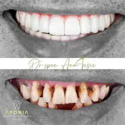 Aponia Dental Centar